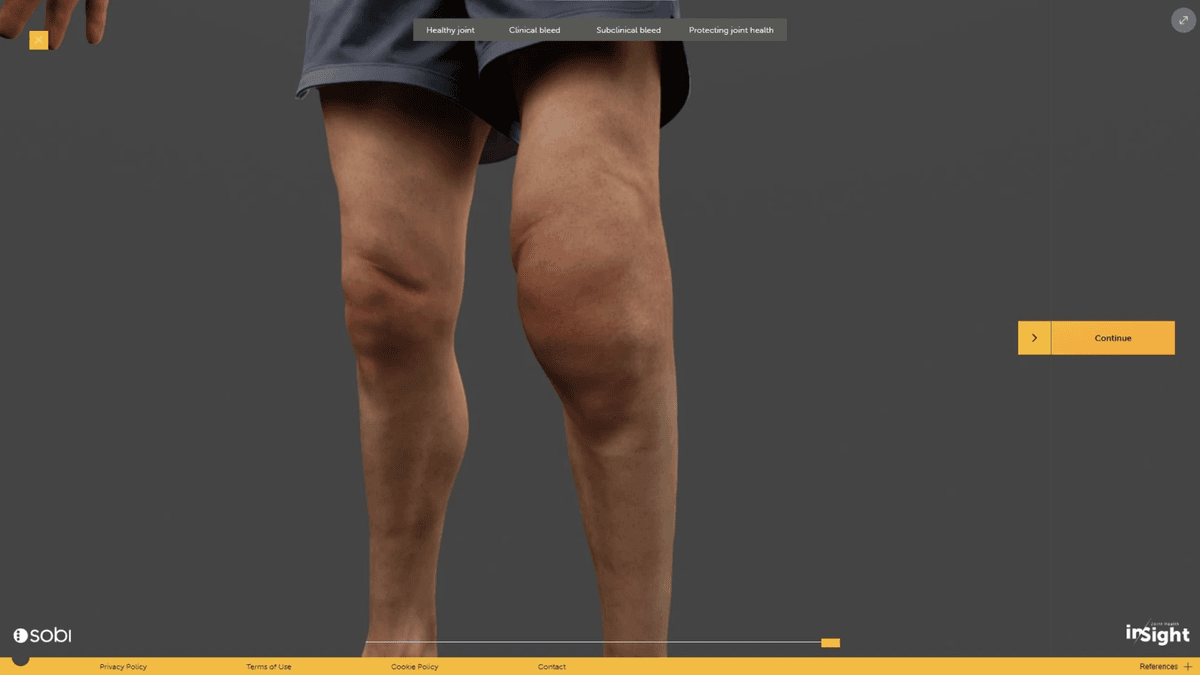 inSight clinical bleed view comparing a healthy leg with a swollen knee joint